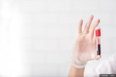 血常规中，“淋巴细胞百分比”偏低是怎么了？有这2个原因