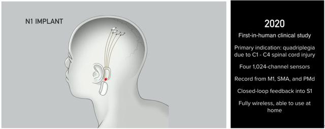 挑战马斯克Neuralink！斯坦福全新脑机接口，直连大脑和硅基芯片