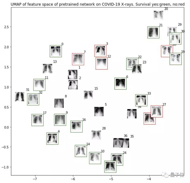 我，AI专家，模型检测COVID-19准确率高达97.5%，约吗