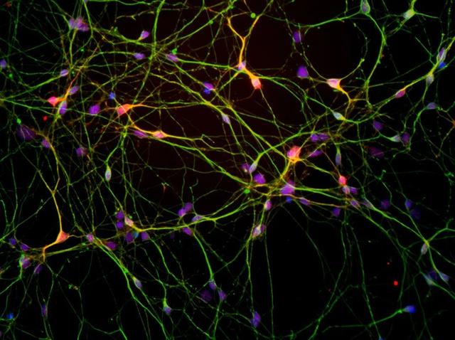 美高校研发APP通过人的声音检测新冠感染；谷歌公布用户定位数据抗击疫情｜科技前沿周报