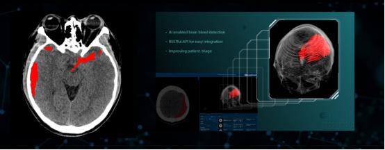 科亚医疗“CuraRad-ICH”获国内首个AI影像诊断系统FDA认证