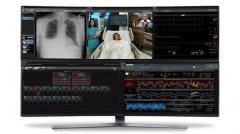 GE Healthcare与微软合作推出帮助临床诊断COVID-19的新技术