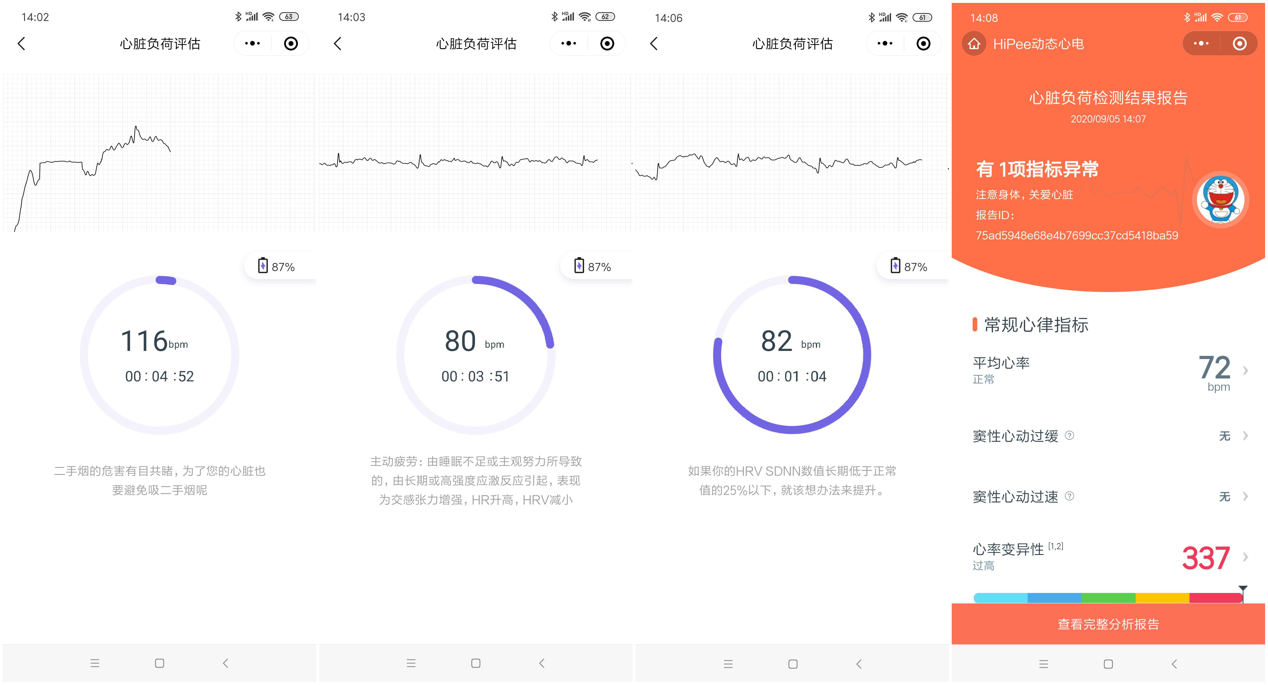 小米有品众筹续命神器，可24小时实时监测心脏，仅499元