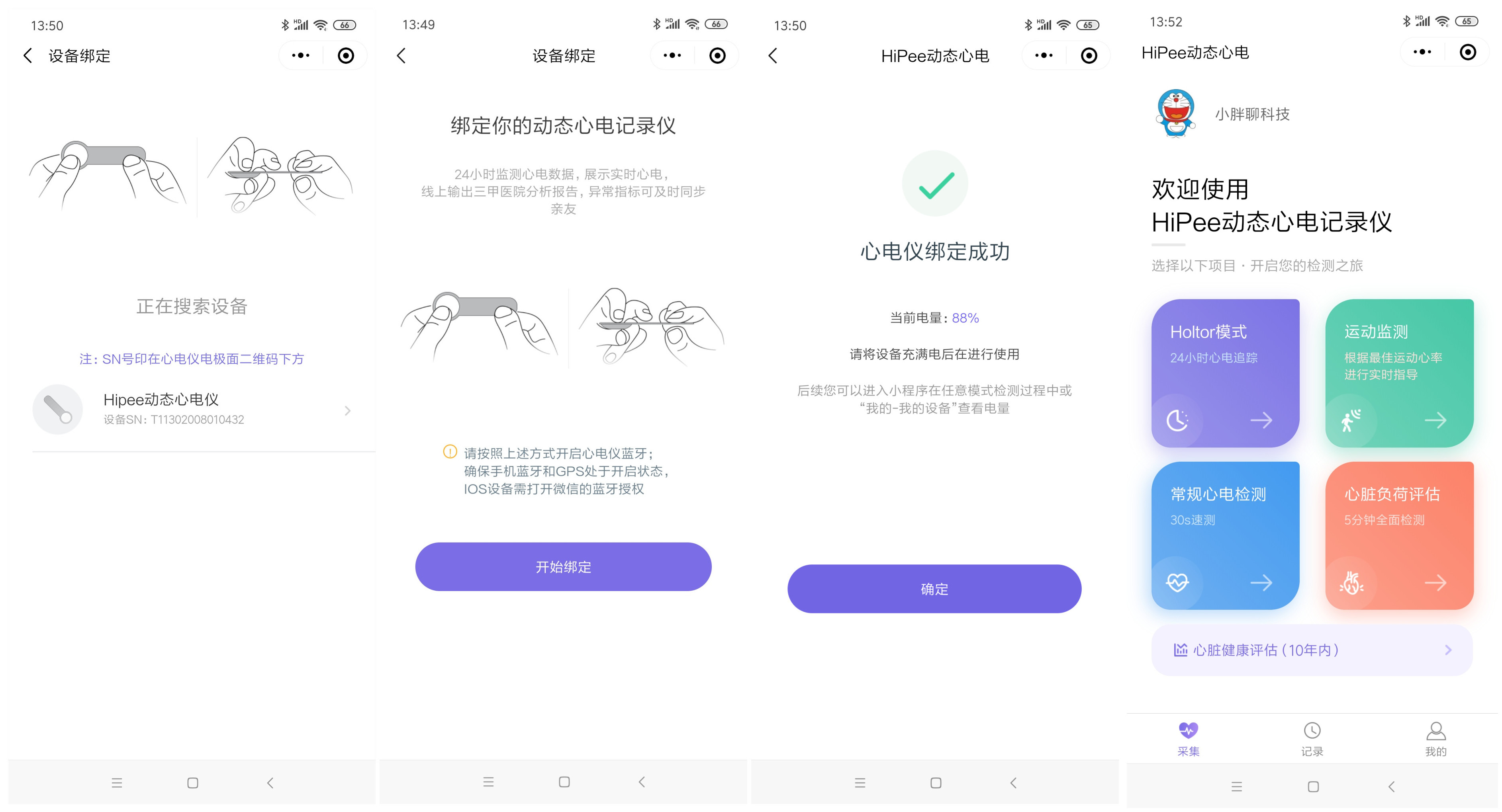 小米有品众筹续命神器，可24小时实时监测心脏，仅499元