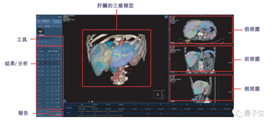 商汤科技招股书详解:40 名教授 250 + 博士 3593 位工程师,AI 收入亚洲第一
